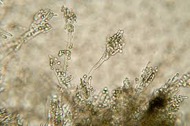 Penicillium: Natural Antibiotic Protection in Your Garden