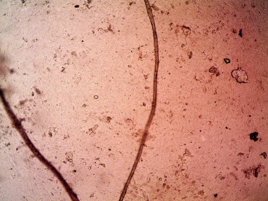 Stenotrophomonas: The Enzyme Factory Living in Your Soil (And Why That's Great)