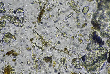 Living Soil vs. Sterile Soil: Why Your Potting Mix Might Be Dead