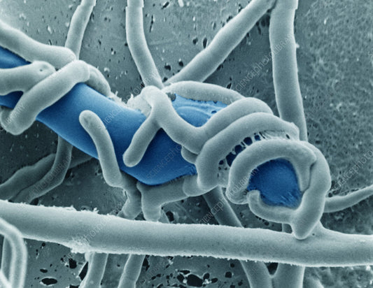Achromobacter: Supporting Plant Growth in Contaminated Soils